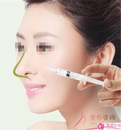 膨體聚四氟乙烯<a href=http://www.f3bb6.cn/listinfo-737-0.html target=_blank class=infotextkey>隆鼻</a>術靠譜嗎？是否有造成感染？