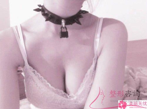 女性哺乳后乳暈變大了能不能縮小