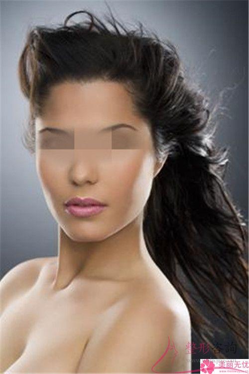 去正規的<a href=http://www.f3bb6.cn/listinfo-4-0.html target=_blank class=infotextkey>整形醫院</a>做<a href=http://www.f3bb6.cn/listinfo-731-0.html target=_blank class=infotextkey>玻尿酸</a>豐面頰手術安全嗎