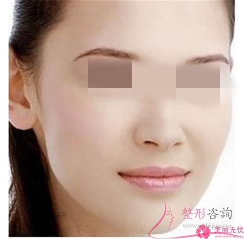 去正規的<a href=http://www.f3bb6.cn/listinfo-4-0.html target=_blank class=infotextkey>整形醫院</a>做<a href=http://www.f3bb6.cn/listinfo-731-0.html target=_blank class=infotextkey>玻尿酸</a>豐面頰手術安全嗎