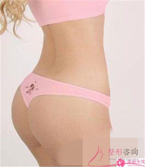 重慶花15489元可以完成自體脂肪<a href=http://www.f3bb6.cn/listinfo-677-0.html target=_blank class=infotextkey>豐臀</a>嗎