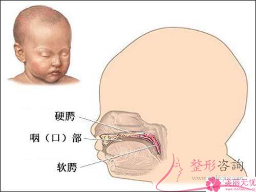 <a href=http://www.f3bb6.cn/listinfo-731-0.html target=_blank class=infotextkey>玻尿酸</a>注射豐嘴唇預測需要多少？