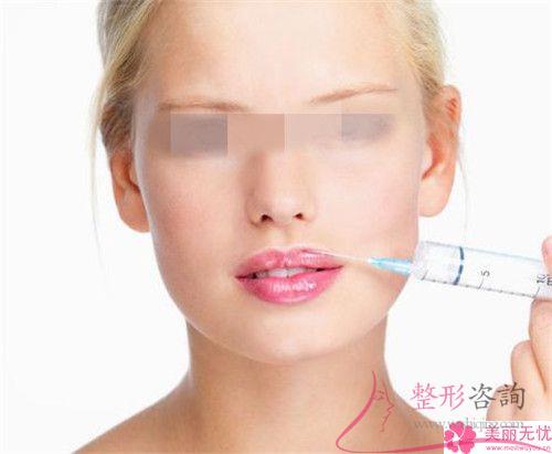 <a href=http://www.f3bb6.cn/listinfo-731-0.html target=_blank class=infotextkey>玻尿酸</a>注射豐嘴唇預測需要多少？