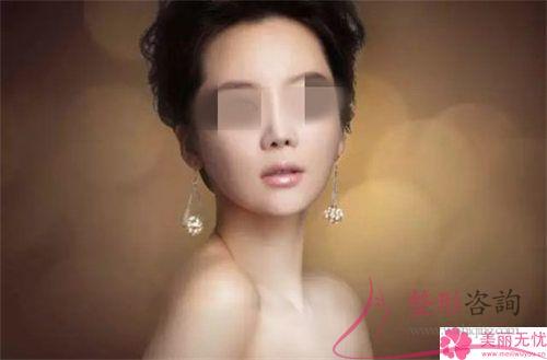 <a href=http://www.f3bb6.cn/listinfo-737-0.html target=_blank class=infotextkey>隆鼻</a>術整形效果有哪些