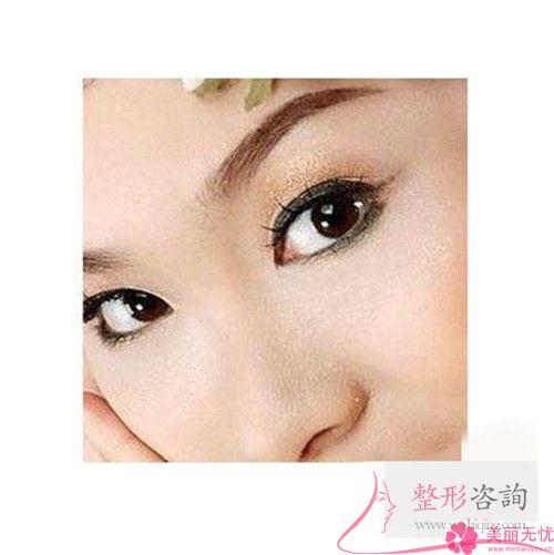 最近紋眉技術和以前比有什么提升