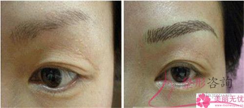 最近紋眉技術和以前比有什么提升