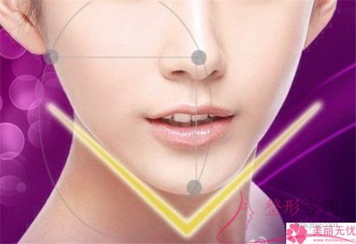 面部兩側腮幫子可以通過哪些方法削掉