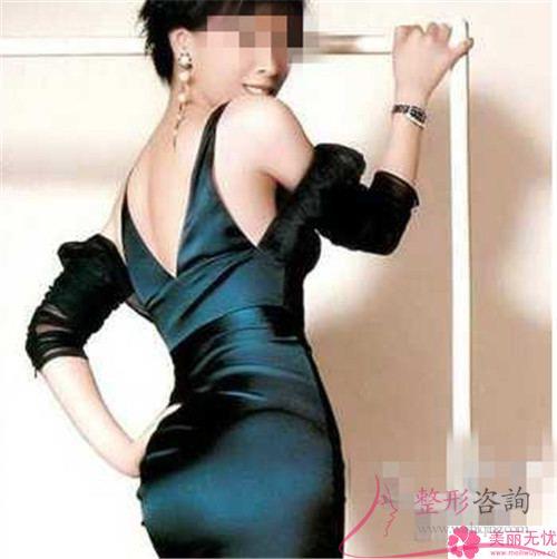 超聲臀部減脂的兩大優(yōu)勢