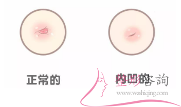 1107389873 1107389873