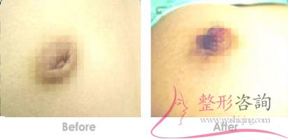 1107494408 1107494408