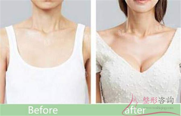 1429502421 1429502421