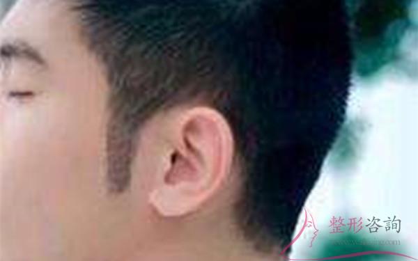 1830017366 1830017366