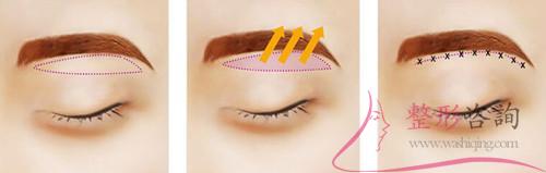 2049551915 2049551915