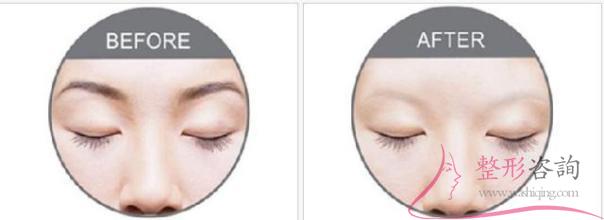 2051377611 2051377611