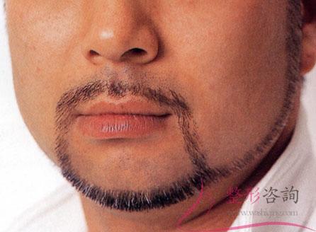 1501125153 1501125153