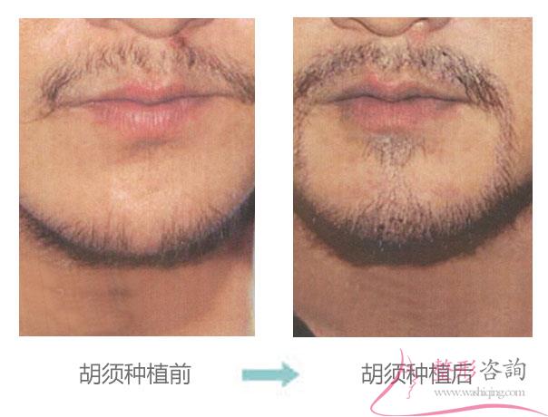 1507304437 1507304437