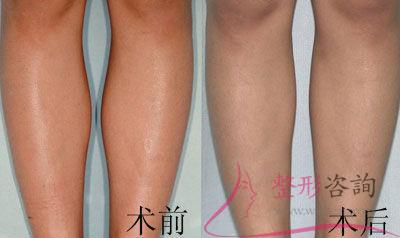 1945543491 1945543491