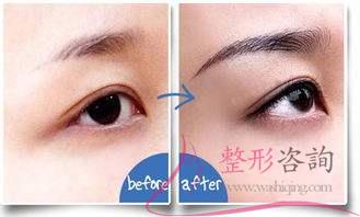 2042316938 2042316938