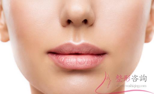 1101206635 1101206635