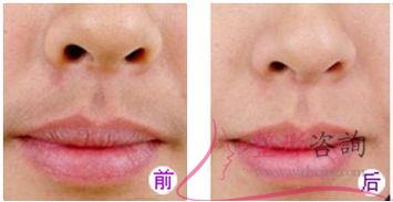 1410005549 1410005549