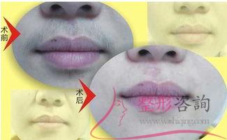 1433255851 1433255851