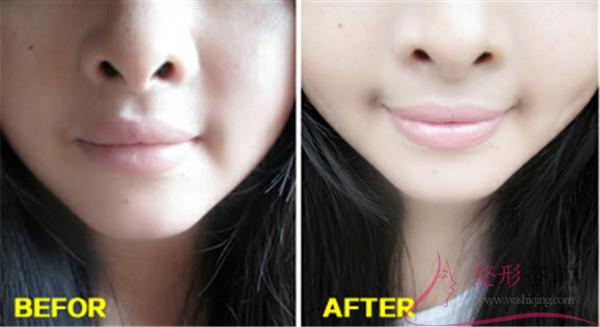 1513567344 1513567344