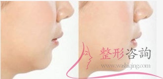 1517206045 1517206045