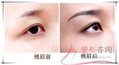 1623561935 1623561935