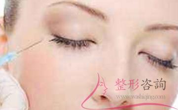 0017261779 0017261779