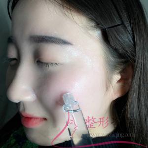 1017255406 1017255406