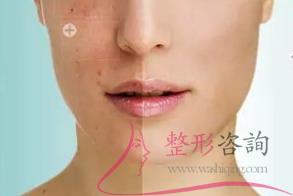 1419169830 1419169830