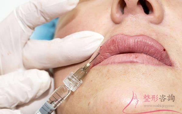 1703367864 1703367864