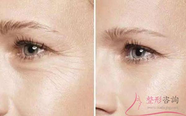 2126149466 2126149466