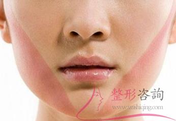 2225479599 2225479599