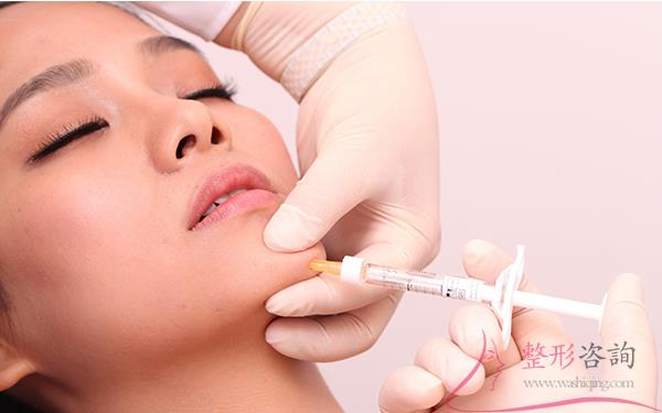 1648219235 1648219235