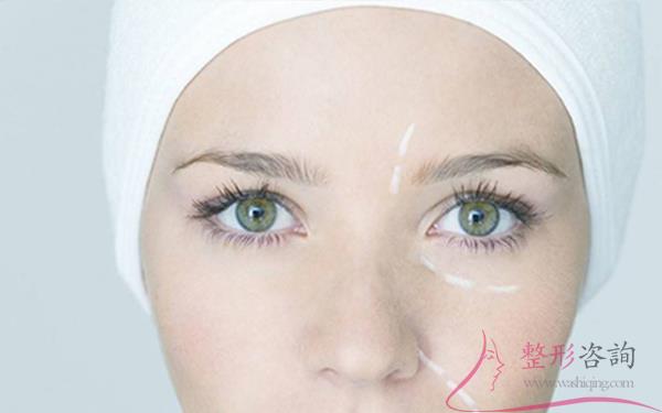 2227074509 2227074509