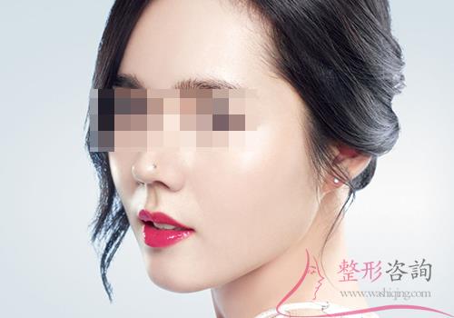 2326466698 2326466698