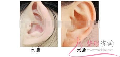 1106311961 1106311961