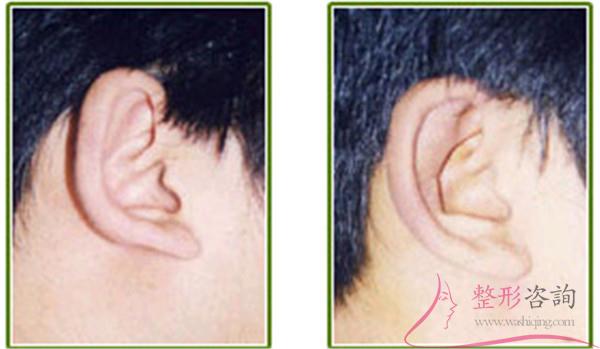 1919405233 1919405233