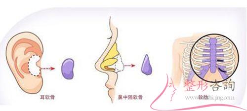 1701532134 1701532134