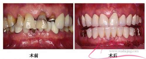 1503443510 1503443510