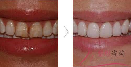 1455078926 1455078926