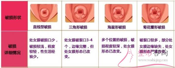 1642284016 1642284016