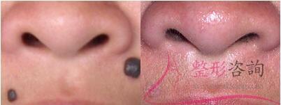 1550202645 1550202645