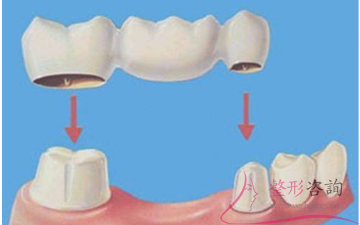 0826216987 0826216987