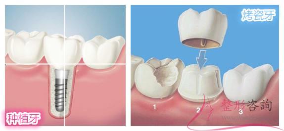 1510131551 1510131551