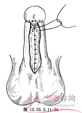 1917057077 1917057077