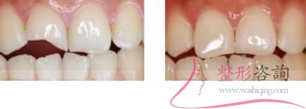 2005433988 2005433988