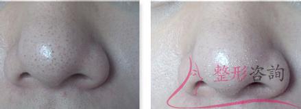 1053155226 1053155226