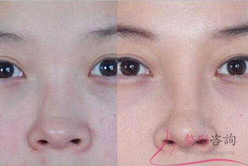 1419002295 1419002295